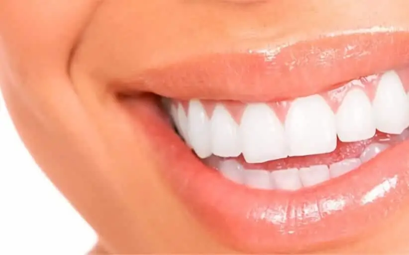 coronas zirconio en córdoba