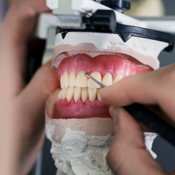 Prótesis dentales fijas y removibles en Córdoba