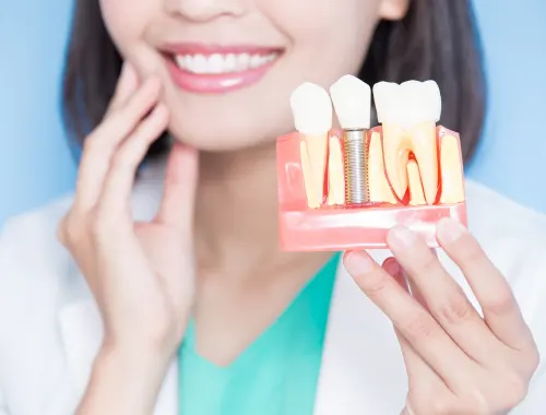 Implantes de carga inmediata