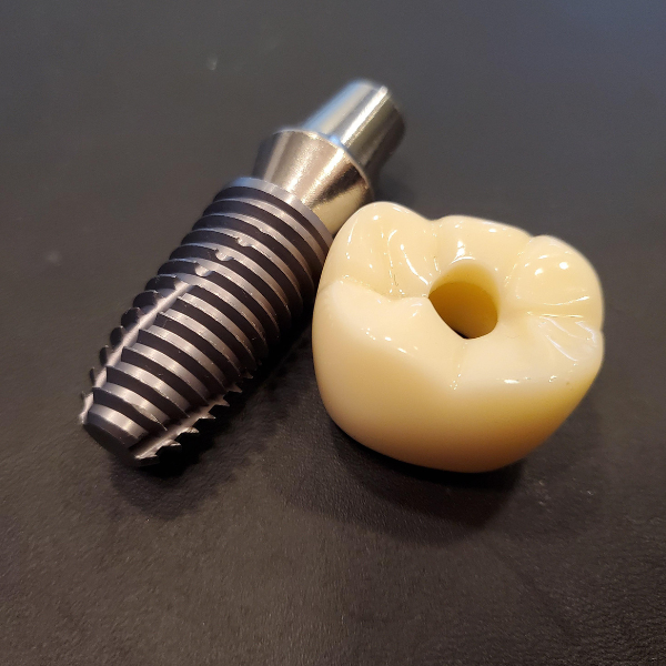 Implantes sin hueso